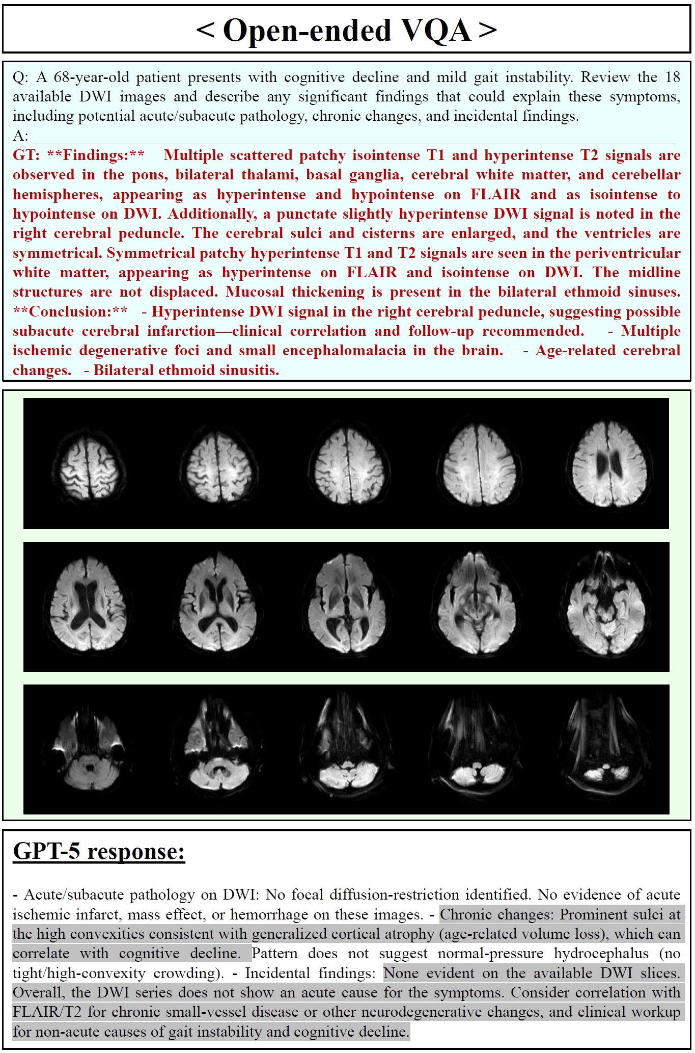GPT-5 Open-ended VQA Samples